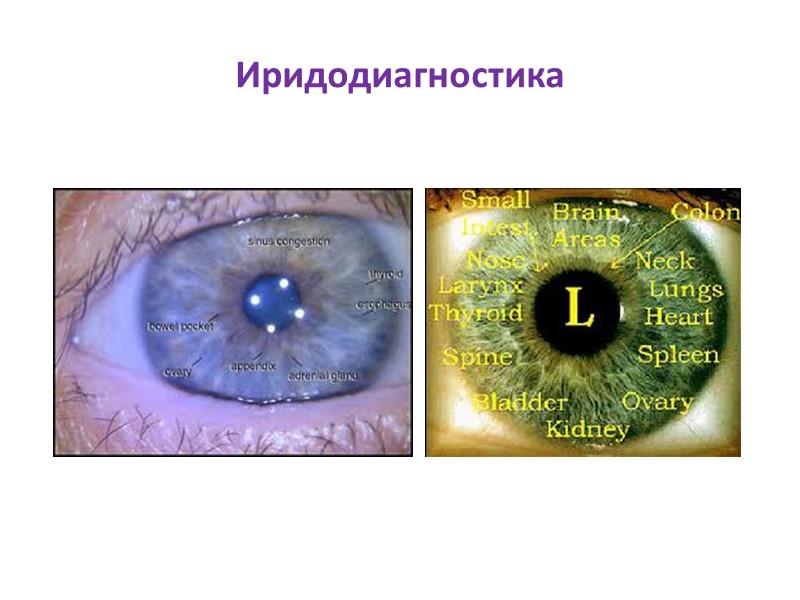 Иридодиагностика